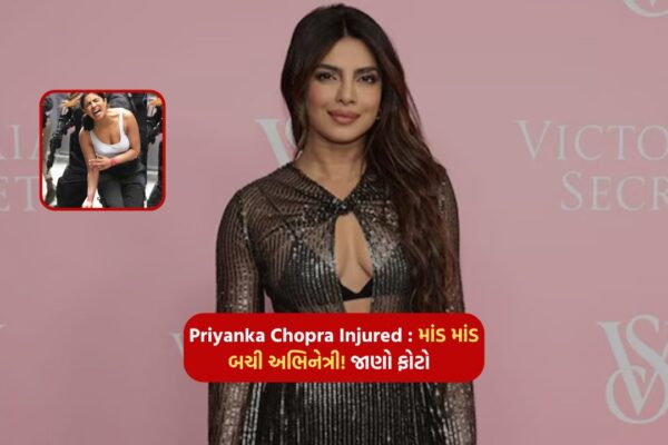 Priyanka Chopra Injured: The actress barely survived! Know photo